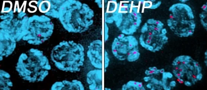 Study in roundworms finds how phthalates in plastic affect egg cell quality, impact fertility